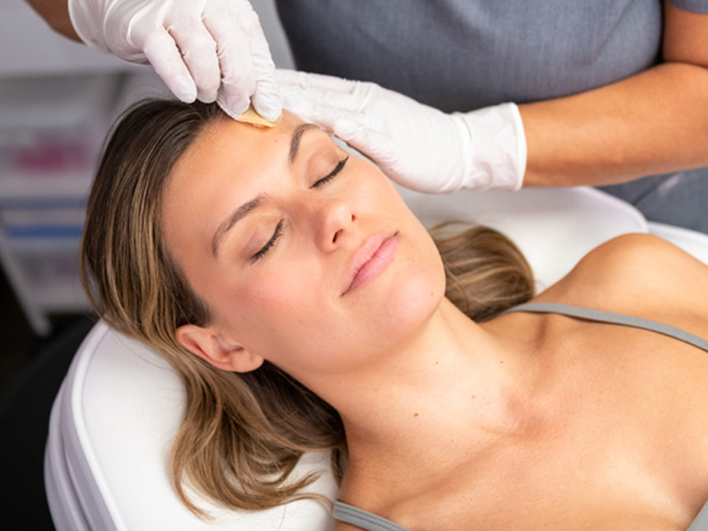 Woman getting VI peel treatment